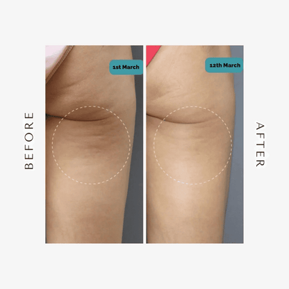 BelleFit™ 3D Anti-Cellulite Sculpting Leggings – Lift Effect & Tummy Control