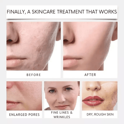 CollagenSkin™ – Anti-Ageing Lifting Mask