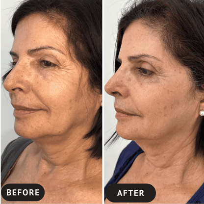 CollagenSkin™ – Anti-Ageing Lifting Mask