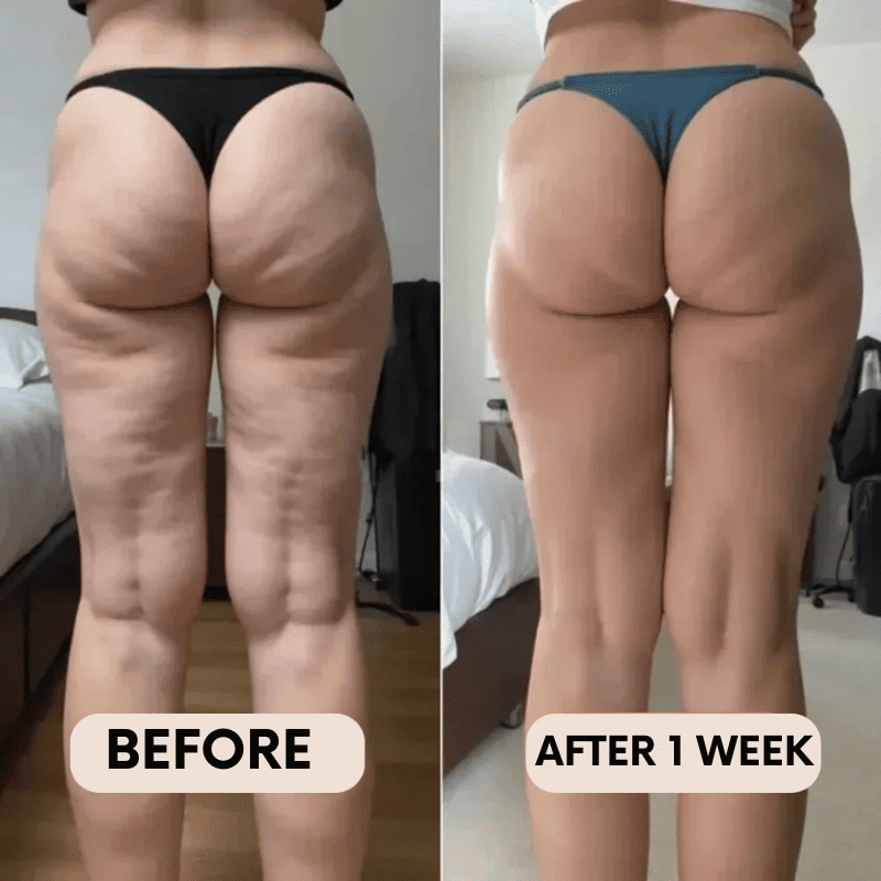 BelleFit™ 3D Anti-Cellulite Sculpting Leggings – Lift Effect & Tummy Control