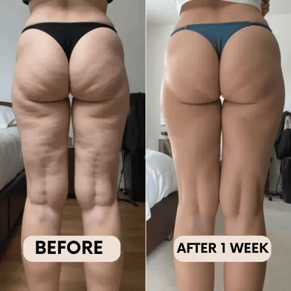 BelleFit™ 3D Anti-Cellulite Sculpting Leggings – Lift Effect & Tummy Control