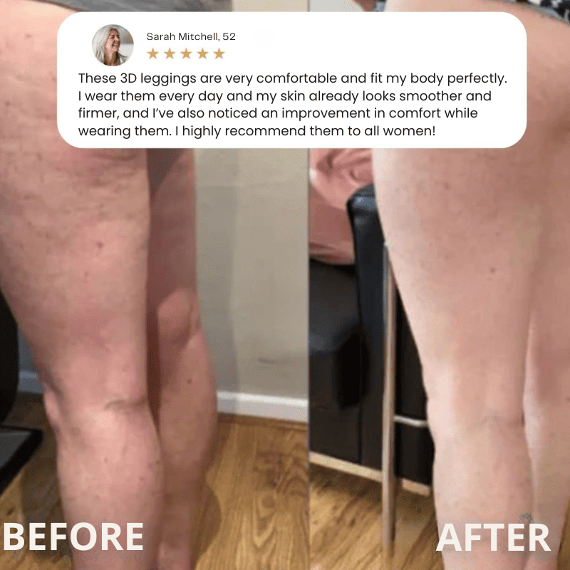 BelleFit™ 3D Anti-Cellulite Sculpting Leggings – Lift Effect & Tummy Control